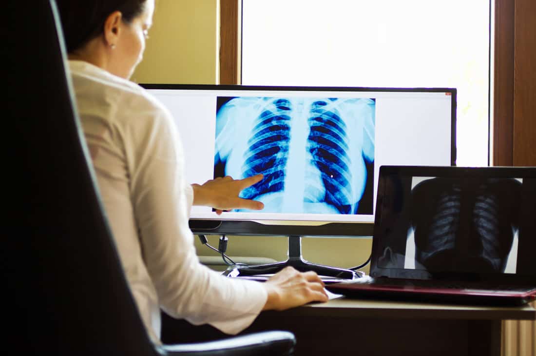 The Benefits of Implementing Digital Radiography - Elite Learning