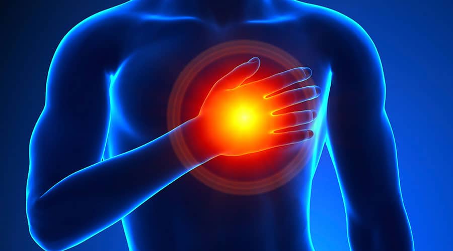 Heart Attack Assessment