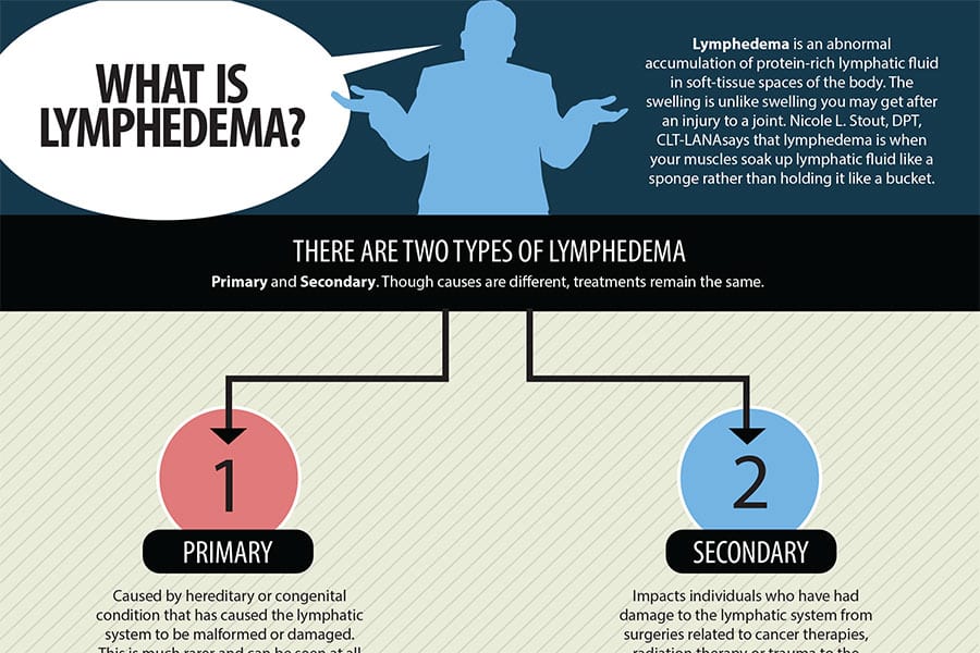 Infographic: What is Lymphedema? - Elite Learning