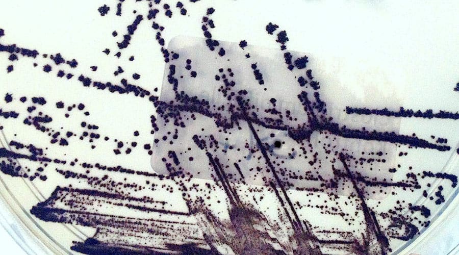 C. difficile