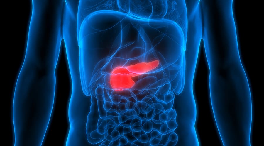 pancreatic tumor model