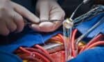 Advances in Abdominal Aortic Aneurysm Management 