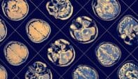 Clinical Neuropsychology: Applications in Practice 