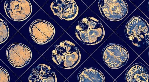 Clinical Neuropsychology: Applications in Practice 