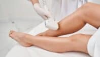 Fundamentals of Laser Hair Removal