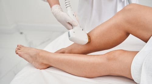 Fundamentals of Laser Hair Removal