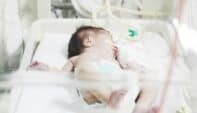 High-Frequency Ventilation in Newborns