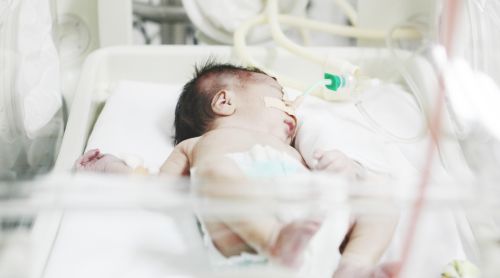 High-Frequency Ventilation in Newborns
