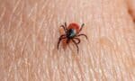 Diagnosis and Management of Tick-Borne Illnesses