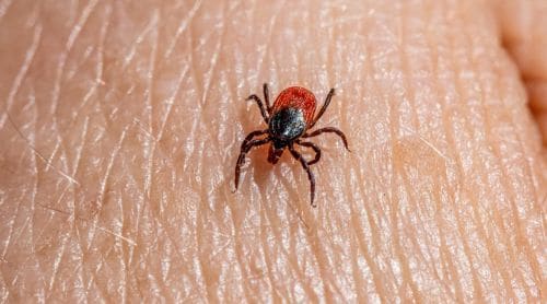 Diagnosis and Management of Tick-Borne Illnesses