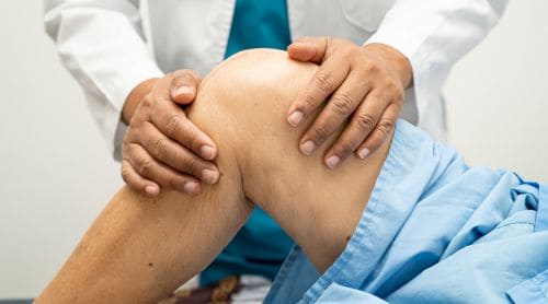 Soft Tissue Work for Complications of TKA