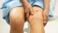 A PT’s Guide to Therapeutic Yoga After Knee Replacement