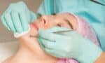 What are Facial Extractions?