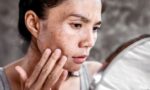 What Pollution Does to Skin (and Nails and Hair)